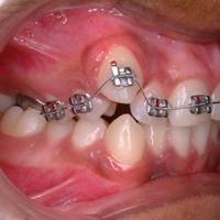 Orthodontics
