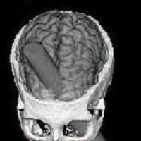 Personality Psychology