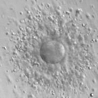 In vitro fertilization