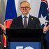 Anthony Albanese